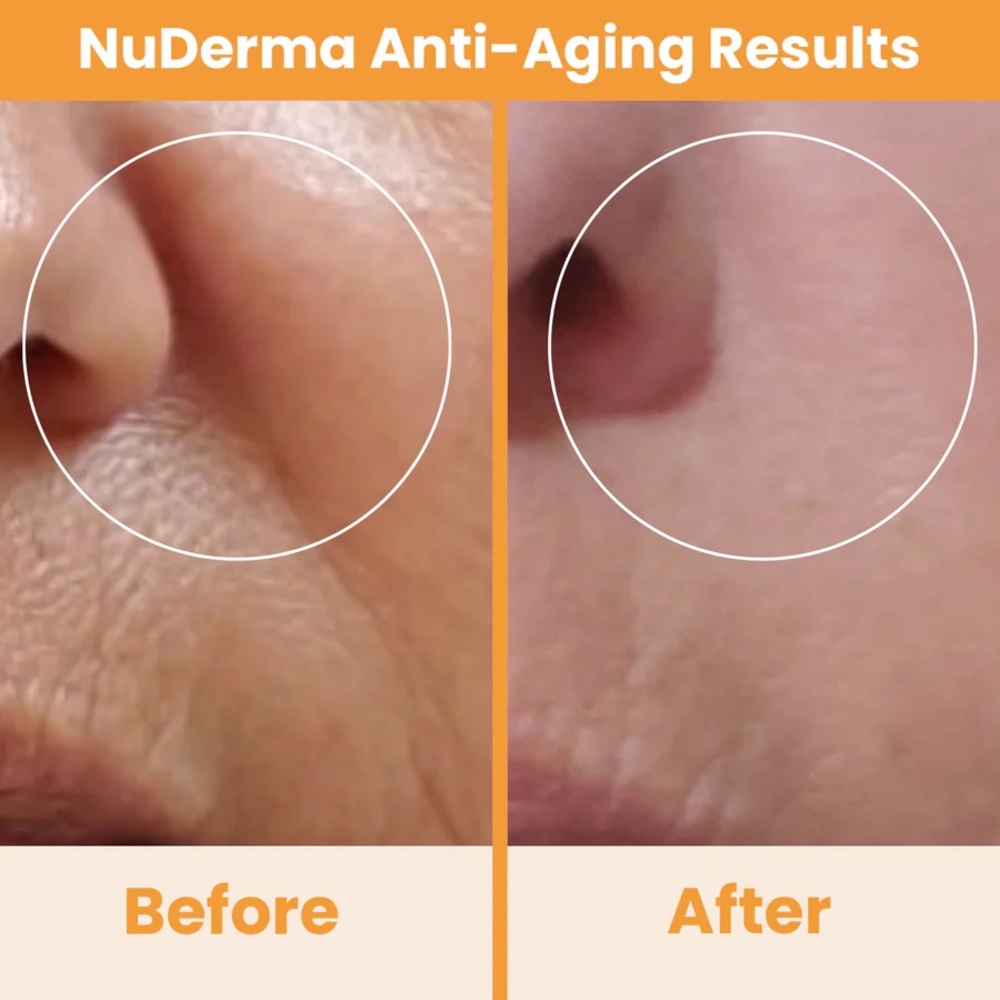 NuDerma Natural Dermal Cell Energy Amplification System - White - Picture 7 of 10